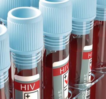 HIV effort let down by test shortages